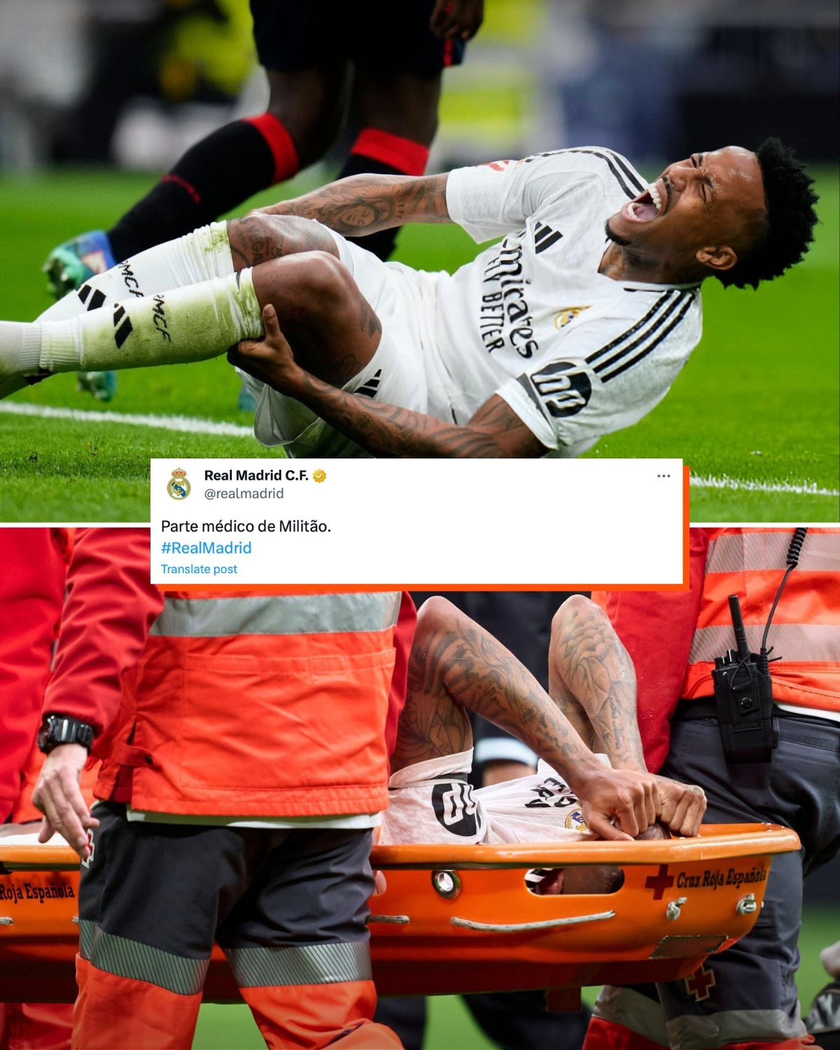 Eder Militao Mengalami Robekan Pada Ligamen Anterior (ACL) di Lutut Kanannya Saat Laga Melawan Osasuna pada 9 November 2024